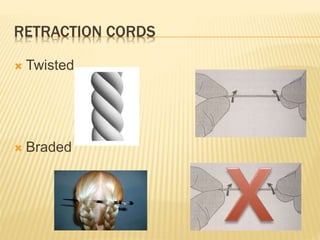 RETRACTION CORDS
 Twisted
 Braded
 