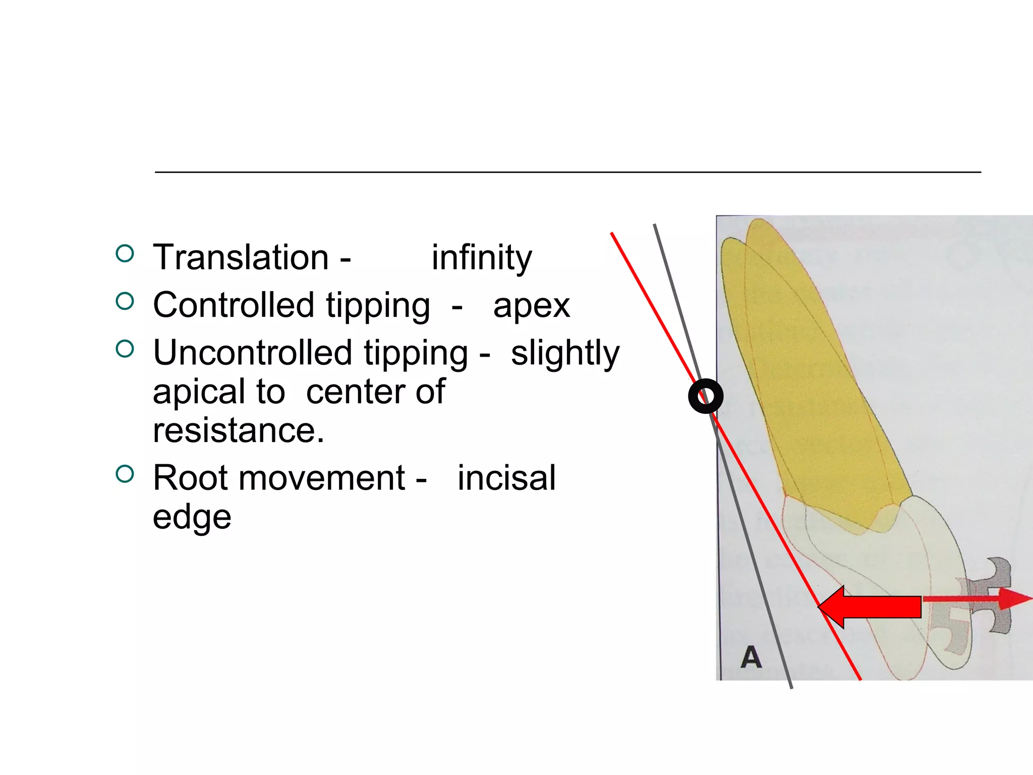 Retraction mechanics | PPT