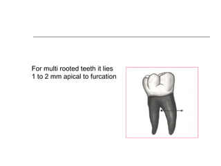 For multi rooted teeth it lies
1 to 2 mm apical to furcation
 