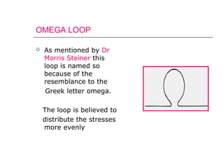 OMEGA LOOP
 As mentioned by Dr
Morris Steiner this
loop is named so
because of the
resemblance to the
Greek letter omega.
The loop is believed to
distribute the stresses
more evenly
 