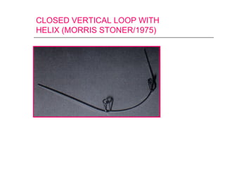 CLOSED VERTICAL LOOP WITH
HELIX (MORRIS STONER/1975)
 