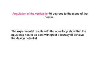 Angulation of the vertical le-70 degrees to the plane of the
bracket
The experimental results with the opus loop show that the
opus loop has to be bent with great accuracy to achieve
the design potential
 