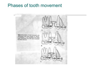 Phases of tooth movement
 