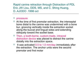 Rapid canine retraction through Distraction of PDL
Eric JW Liou, DDS, MS, and C. Shing Huang,
D..AJODO .1998 oct
 procesure
 At the time of first premolar extraction, the interseptal
bone distal to the canine was undermined with a bone
bur, grooving vertically inside the extraction socket
along the buccal and lingual sides and extending
obliquely toward the socket base.
 Then, a tooth-borne, custom-made, intraoral
distraction device was placed to distract the canine
distally into the extraction space.
 It was activated 0.5 to 1.0 mm/day immediately after
the extraction. The anchor units were the second
premolar and first molar
 