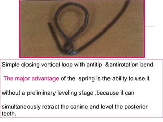Simple closing vertical loop with antitip &antirotation bend.
The major advantage of the spring is the ability to use it
without a preliminary leveling stage ,because it can
simultaneously retract the canine and level the posterior
teeth.
 