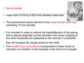  Spring design
 made from 0.016 by 0.022 inch stainless steel wire.
 The predominant active element is the ovoid double helix loop
extending 10 mm apically.
 It is included in order to reduce the load/deflection of the spring
and is placed gingivally so that activation will cause a tipping of
the short horizontal arm (attached to the canine) in a direction
that will increase the couple acting on the tooth.
 The smaller loop occlusally is incorporated to lower levels of
activation on insertion in the brackets in the short arm (couple)
 