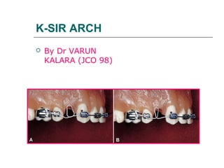 K-SIR ARCH
 By Dr VARUN
KALARA (JCO 98)
 