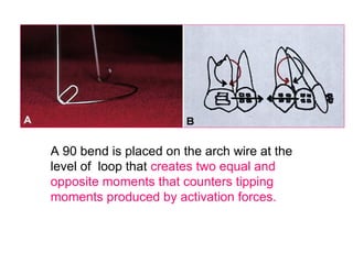A 90 bend is placed on the arch wire at the
level of loop that creates two equal and
opposite moments that counters tipping
moments produced by activation forces.
 
