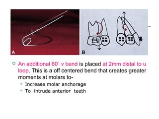  An additional 60˚ v bend is placed at 2mm distal to u
loop. This is a off centered bend that creates greater
moments at molars to-
 Increase molar anchorage
 To intrude anterior teeth
 