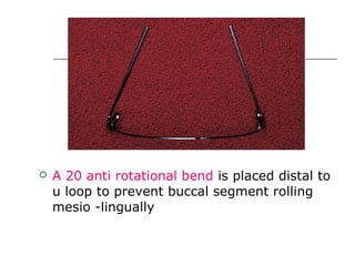  A 20 anti rotational bend is placed distal to
u loop to prevent buccal segment rolling
mesio -lingually
 