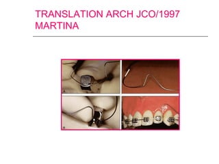 TRANSLATION ARCH JCO/1997
MARTINA
 