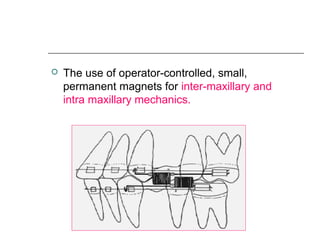  The use of operator-controlled, small,
permanent magnets for inter-maxillary and
intra maxillary mechanics.
 