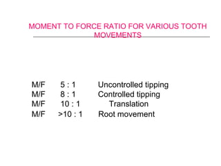 MOMENT TO FORCE RATIO FOR VARIOUS TOOTH
MOVEMENTS
M/F 5 : 1 Uncontrolled tipping
M/F 8 : 1 Controlled tipping
M/F 10 : 1 Translation
M/F >10 : 1 Root movement
 