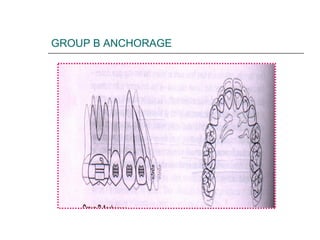 GROUP B ANCHORAGE
 