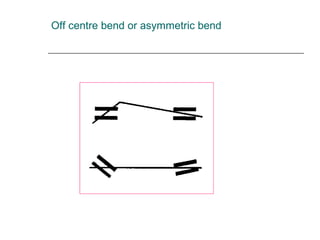 Off centre bend or asymmetric bend
 