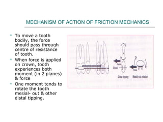 MECHANISM OF ACTION OF FRICTION MECHANICS
 To move a tooth
bodily, the force
should pass through
centre of resistance
of tooth.
 When force is applied
on crown, tooth
experiences both
moment (in 2 planes)
& force
 One moment tends to
rotate the tooth
mesial- out & other
distal tipping.
 