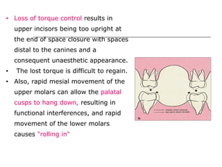 • Loss of torque control results in
upper incisors being too upright at
the end of space closure with spaces
distal to the canines and a
consequent unaesthetic appearance.
• The lost torque is difficult to regain.
• Also, rapid mesial movement of the
upper molars can allow the palatal
cusps to hang down, resulting in
functional interferences, and rapid
movement of the lower molars
causes "rolling in"
 