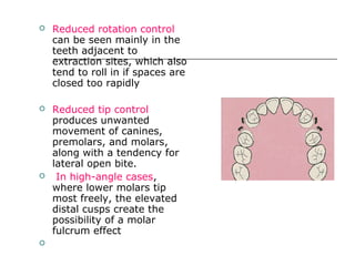  Reduced rotation control
can be seen mainly in the
teeth adjacent to
extraction sites, which also
tend to roll in if spaces are
closed too rapidly
 Reduced tip control
produces unwanted
movement of canines,
premolars, and molars,
along with a tendency for
lateral open bite.
 In high-angle cases,
where lower molars tip
most freely, the elevated
distal cusps create the
possibility of a molar
fulcrum effect

 