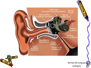 Retraso Del Lenguaje Audiógeno  