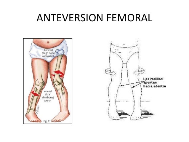 Como distinguir el dolor de los riñones de la osteocondrosis