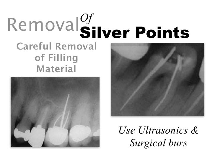 Retreatment (4th year)
