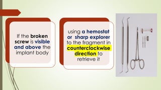 If the broken
screw is visible
and above the
implant body
using a hemostat
or sharp explorer
to the fragment in
counterclockwise
direction to
retrieve it
 
