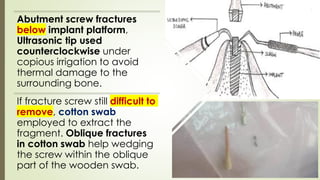 Abutment screw fractures
below implant platform,
Ultrasonic tip used
counterclockwise under
copious irrigation to avoid
thermal damage to the
surrounding bone.
If fracture screw still difficult to
remove, cotton swab
employed to extract the
fragment. Oblique fractures
in cotton swab help wedging
the screw within the oblique
part of the wooden swab.
 
