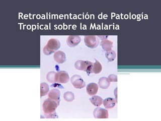 Retroalimentación de Patología Tropical sobre la Malaria 