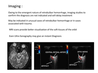Imaging :
May be indicated in unusual cases of retrobulbar hemorrhage or in cases
associated with trauma.
MRI scans provide better visualization of the soft tissues of the orbit
Even Ultra Sonography may give an instant Diagnosis
Owing to the emergent nature of retrobulbar hemorrhage, imaging studies to
confirm the diagnosis are not indicated and will delay treatment
 