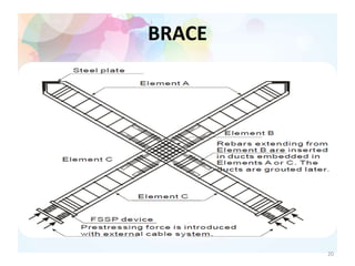 BRACE
20
 