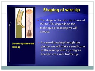 Retrograde cto interv.