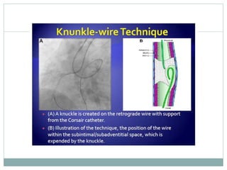 Retrograde cto interv.