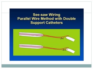 Retrograde cto interv.