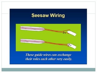 Retrograde cto interv.
