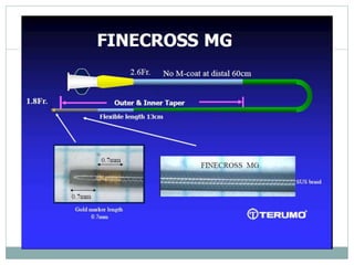 Retrograde cto interv.