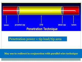 Penetration power = tip load/tip area
May use to redirect in conjunction with parallel wire technique
 