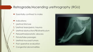 Utricular Cyst Rgu Retrograde urethrography (RGU) and MCU.pptx
