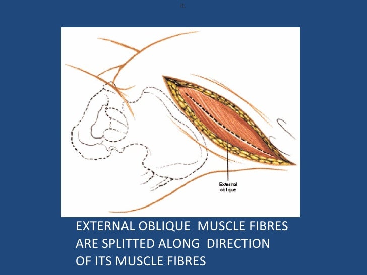 Retroperitoneal approach to the lumbar spine1