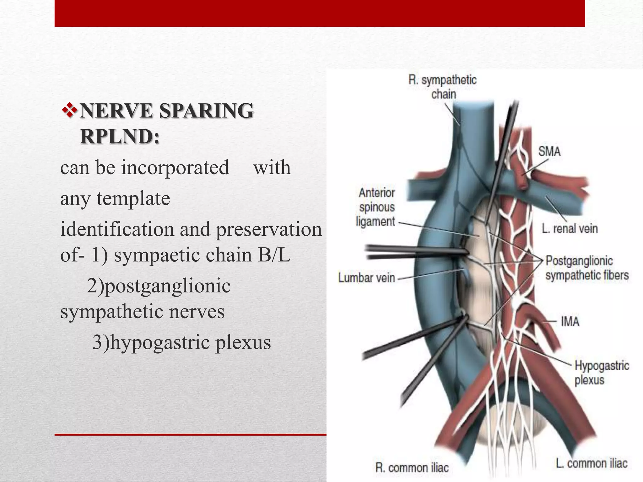 NERVE SPARING
RPLND:
can be incorporated with
any template
identification and preservation
of- 1) sympaetic chain B/L
2)postganglionic
sympathetic nerves
3)hypogastric plexus
 