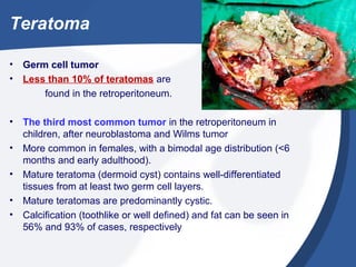 Teratoma
• Germ cell tumor
• Less than 10% of teratomas are
found in the retroperitoneum.
• The third most common tumor in the retroperitoneum in
children, after neuroblastoma and Wilms tumor
• More common in females, with a bimodal age distribution (<6
months and early adulthood).
• Mature teratoma (dermoid cyst) contains well-differentiated
tissues from at least two germ cell layers.
• Mature teratomas are predominantly cystic.
• Calcification (toothlike or well defined) and fat can be seen in
56% and 93% of cases, respectively
 