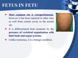 FETUS IN FETU
♣ Most common site is retroperitoneum,
however it has been reported in other sites
as well from cranial cavity to the scrotal
sac
♣ It is differentiated from teratoma by the
presence of vertebral organization with
limb buds and organ systems.
♣ Unlike teratomas, it is a benign condition.
 