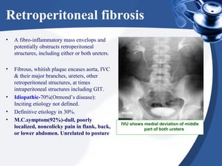 Retroperitoneal fibrosis
• A fibro-inflammatory mass envelops and
potentially obstructs retroperitoneal
structures, including either or both ureters.
• Fibrous, whitish plaque encases aorta, IVC
& their major branches, ureters, other
retroperitoneal structures, at times
intraperitoneal structures including GIT.
• Idiopathic-70%(Ormond’s disease):
Inciting etiology not defined.
• Definitive etiology in 30%.
• M.C.symptom(92%)-dull, poorly
localized, noncolicky pain in flank, back,
or lower abdomen. Unrelated to posture
IVU shows medial deviation of middle
part of both ureters
 