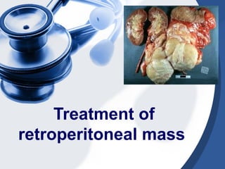 Treatment of
retroperitoneal mass
 