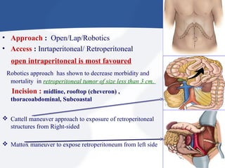 • Approach : Open/Lap/Robotics
• Access : Inrtaperitoneal/ Retroperitoneal
open intraperitoneal is most favoured
Robotics approach has shown to decrease morbidity and
mortality in retroperitoneal tumor of size less than 3 cm.
Incision : midline, rooftop (cheveron) ,
thoracoabdominal, Subcoastal
 Cattell maneuver approach to exposure of retroperitoneal
structures from Right-sided
 Mattox maneuver to expose retroperitoneum from left side
 