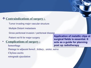  Contraindications of surgery :
Tumor invading major vascular structure
Multiple Distant metastasis
Gross peritoneal invasion / peritoneal disease
Patient not fit for major surgery
• Complications of surgery :
hemorrhage
Damage to adjacent bowel , kidney , ureter, nerve
Chylous ascitis
retrograde ejaculation
Application of metallic clips at
surgical fields is essential. It
acts as a guide for planning
post op radiotherapy
Application of metallic clips at
surgical fields is essential. It
acts as a guide for planning
post op radiotherapy
 