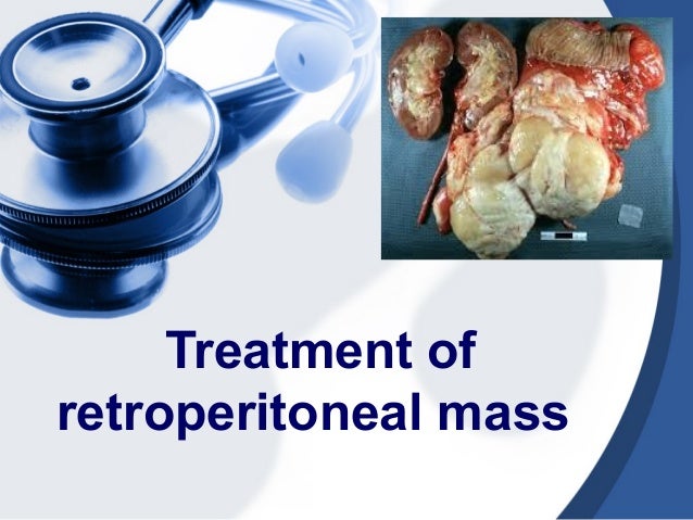 Hormone Therapy For Retroperitoneal Cancer