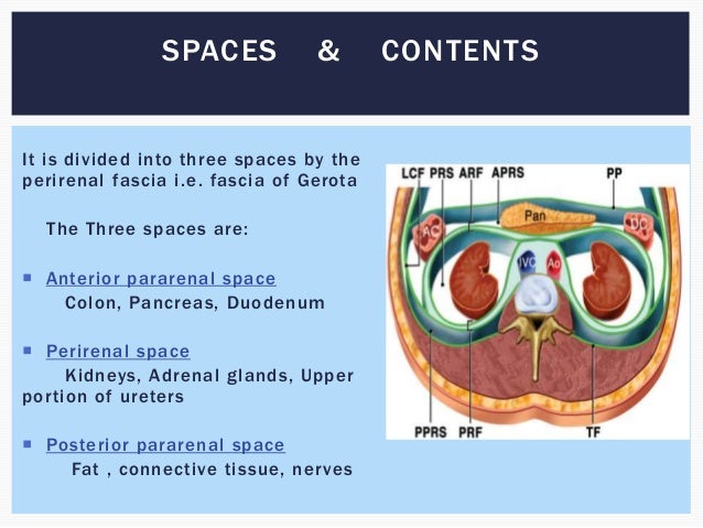Retroperitoneal mass