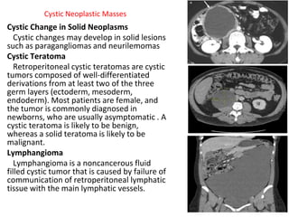 Cystic Neoplastic Masses
Cystic Change in Solid Neoplasms
Cystic changes may develop in solid lesions
such as paragangliomas and neurilemomas
Cystic Teratoma
Retroperitoneal cystic teratomas are cystic
tumors composed of well-differentiated
derivations from at least two of the three
germ layers (ectoderm, mesoderm,
endoderm). Most patients are female, and
the tumor is commonly diagnosed in
newborns, who are usually asymptomatic . A
cystic teratoma is likely to be benign,
whereas a solid teratoma is likely to be
malignant.
Lymphangioma
Lymphangioma is a noncancerous fluid
filled cystic tumor that is caused by failure of
communication of retroperitoneal lymphatic
tissue with the main lymphatic vessels.
 