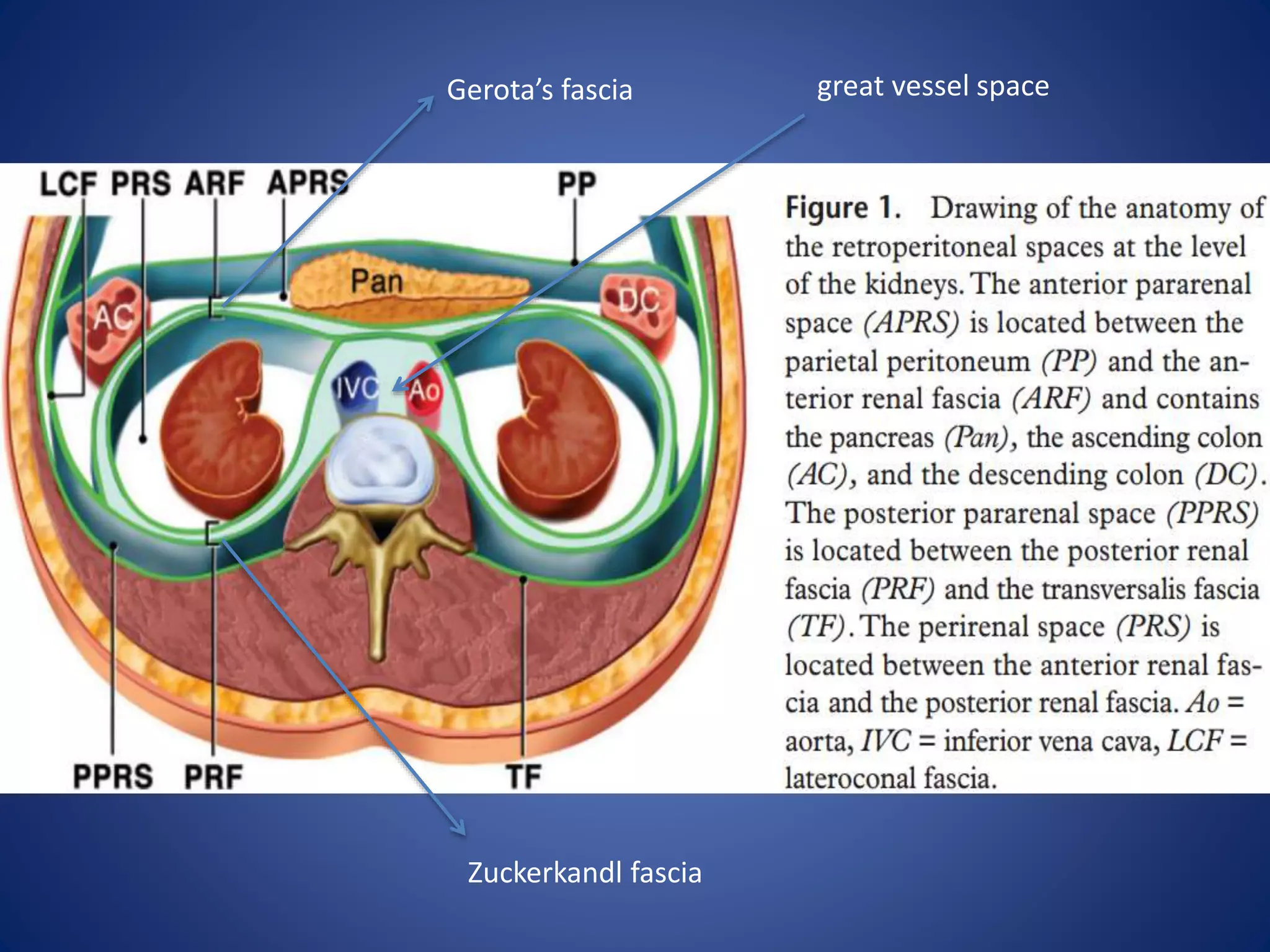 Gerota’s fascia
Zuckerkandl fascia
great vessel space
 