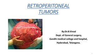 RETROPERITONEAL
TUMORS
By:Dr.B.Vinod
Dept. of General surgery,
Gandhi medical college and hospital,
Hyderabad, Telangana.
1
 
